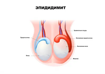 Перекрут яичка | Аксис Медицина | Дзен