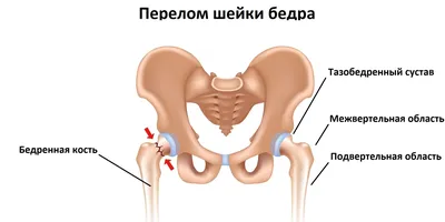 Перелом надколенника – причины, симптомы, диагностика и лечение у взрослых  | «Будь Здоров»