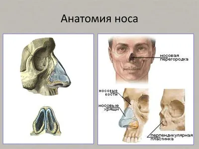 Перелом костей носа карта вызова