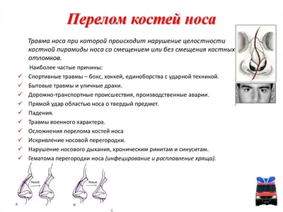 Сделать рентген костей носа и носоглотки в Москве | Добромед