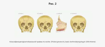 Хоккеист СКА Зыков получил серьезный перелом лицевой кости - РИА Новости  Спорт, 04.02.2023