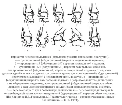 Некрасов Михаил - Подкостный перелом лодыжки😖 Спасибо большое всем за  поддержку! | Facebook