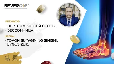 Косточка» на ноге или Вальгусная деформация большого пальца | Городская  клиническая больница им. В. М. Буянова