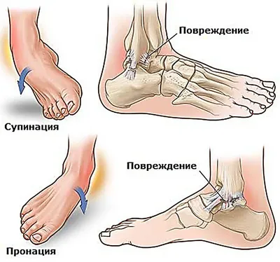 Что делать, если сломал палец на ноге? - полезные статьи от специалистов -  Медицинский центр «АудиоМед»