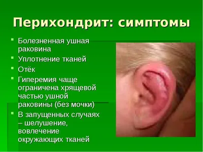 Воспалительные заболевания наружного уха - презентация онлайн