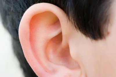 Симптомы и лечение наружного отита у взрослых, фото острого отита наружного  уха