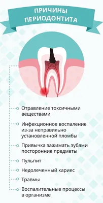 Что такое периодонтит - Доказательная медицина для всех