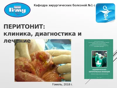 ❇Перитонит ❇– это опасное для... - Avangard Hospital Osh | Facebook