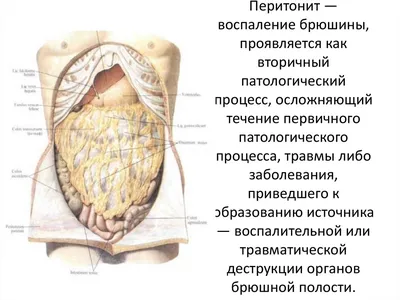 Фиброзный перитонит - Атлас патологий свиней - pig333.ru, от фермы к рынку