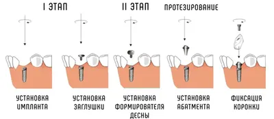 Гнойник (прыщ, абсцесс зуба) на десне – что делать, лечение нарыва на десне