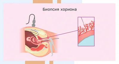 Скрининг во время беременности: что это такое и для чего он нужен?