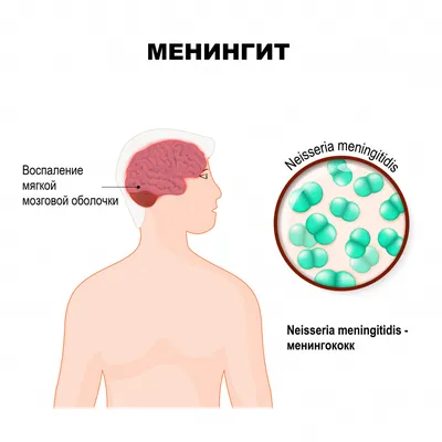 Инфекционные экзантемы у детей – тема научной статьи по клинической  медицине читайте бесплатно текст научно-исследовательской работы в  электронной библиотеке КиберЛенинка