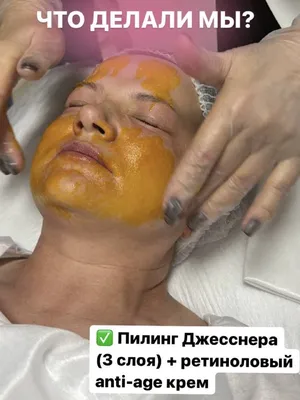 Пилинг Джесснера MedicControlPeel для лица по доступной цене в Долгопрудном  - клиника косметологии Code Beauty Medicine