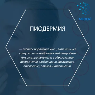 Противомикробные средства Биосинтез Эритромицин - «Пиодермия у 5-ти  месячного малыша. Подробности лечения, результат примененияКогда высыпало и  зачесалось, а дерматолог ставит странный диагноз» | отзывы