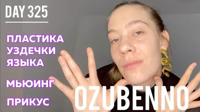 Пластика уздечки языка, стоимость пластики уздечки языка в  стоматологической клинике в Люблино