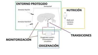 Плацентарная полка» или плацента «окружённая валиком»(placenta  circumvallata). Что же это такое!? Это аномалия развития плаценты, при… |  Instagram