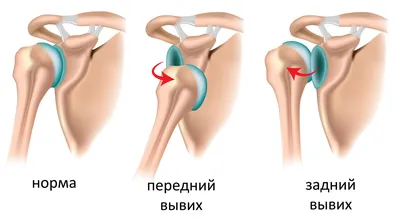 плечо боли девушки стоковое фото. изображение насчитывающей женщина -  9566720