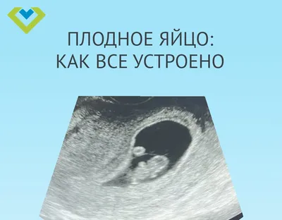 Плодное яйцо: как все устроено | clinica-repromed | Дзен