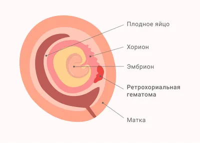 Может ли это быть плодное яйцо? - Вопросы о планировании беременности -  BabyPlan