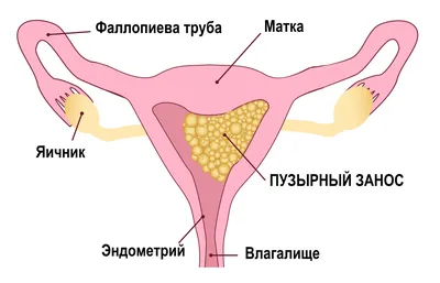 Плодное яйцо: как все устроено | clinica-repromed | Дзен