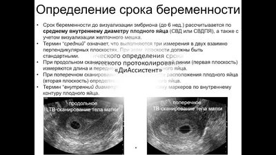 Маленькое плодное яйцо ! - Вопросы о планировании беременности - BabyPlan