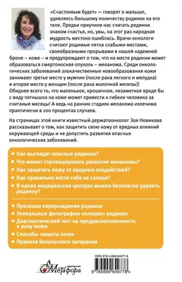 Злокачественные и доброкачественные родинки — как отличить родинку от  меланомы | Новости Украины | LIGA.net