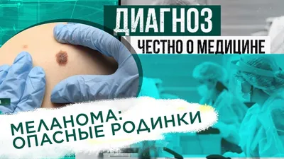 Опасны ли родинки — блог медицинского центра ОН Клиник