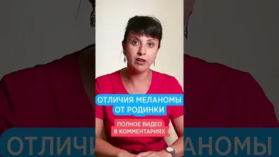 Опасные родинки: признаки злокачественных родинок, фото — MLC