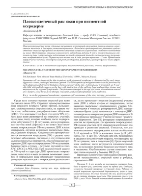 Плоскоклеточный рак кожи у пациента с положительными серологическими  реакциями на сифилис – тема научной статьи по клинической медицине читайте  бесплатно текст научно-исследовательской работы в электронной библиотеке  КиберЛенинка