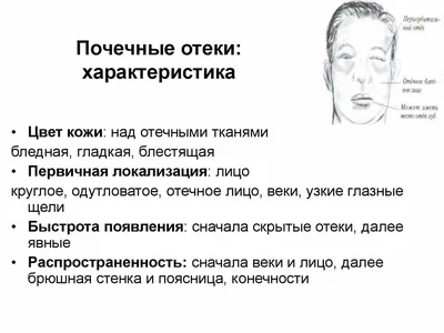 Отекают ноги? 🔍Самостоятельно разбираемся в причине отека ног и что с этим  делать. Часть вторая: 💓 сердечные, почечные и лекарственные. | Врач  Алексей Мареев | Дзен