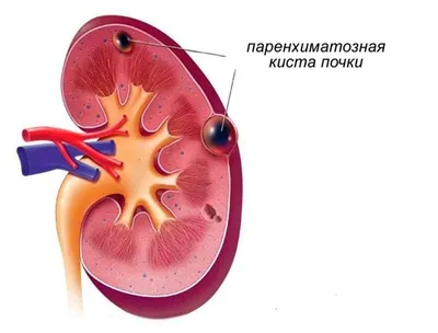 Обучающий медицинский плакат анатомия Строение почки А2 - купить с  доставкой по выгодным ценам в интернет-магазине OZON (1145371489)