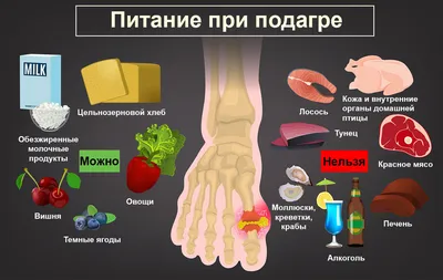 Лечение подагры у мужчин и женщин - признаки и симптомы