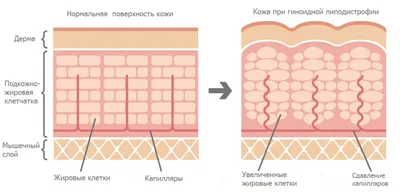 Шишка у собак на спине – откуда появляется и как лечить