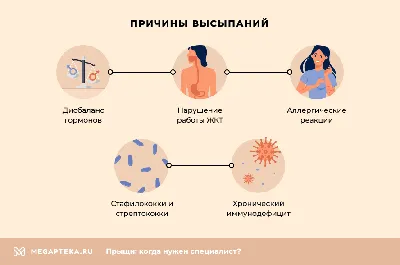 Прыщи на лбу: причины появления, как избавиться от сыпи и мелких высыпаний,  процедуры для лечения заболевания