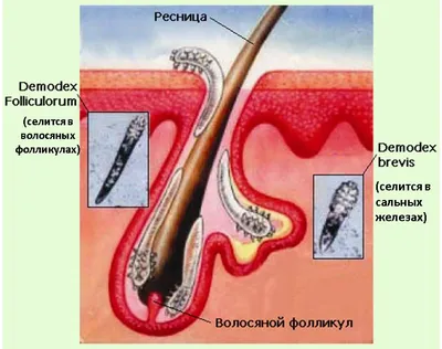 Подкожный клещ