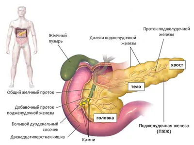 Поджелудочная железа, заболевания.