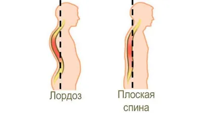 3 способа разгрузить поясницу | Пикабу