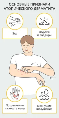 Атопический дерматит: причины, симптомы и лечение у детей и взрослых