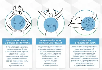 Замучил лактостаз». Как его победить?