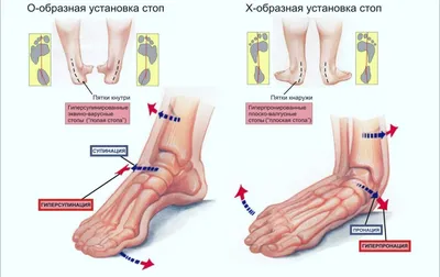 Почему болят ноги у женщин и мужчин от бедра до стопы и ниже колен, что  делать