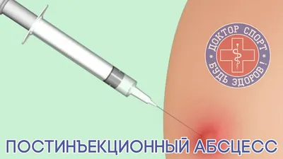 Увеличения губ гиалуроновой кислотой - 7 «нельзя» после процедуры