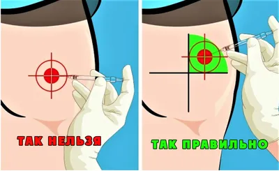 Терапевт Слободина: боль после уколов таит в себе опасность