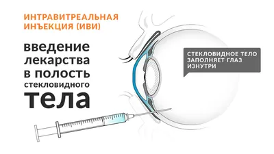 Лечение болезней колен на ранних стадиях - есть ли польза от уколов |  Главная