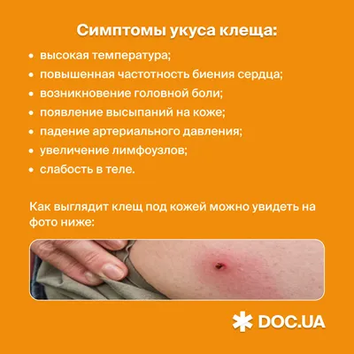 Укус клеща | PUUGIINFO.EE