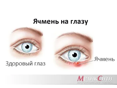 Спасение чувствительной и повреждённой кожи вокруг глаз с La Roche-Posay  Toleriane Ultra Eye Contour... Или не спасение? | Отзывы покупателей |  Косметиста