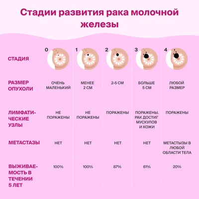 Симптомы рака молочной железы — Узнай больше с MedUnion!