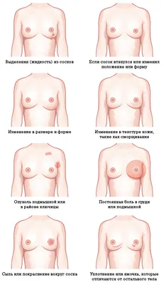 Как определить рак груди вовремя: что необходимо знать | Маммологический  Центр