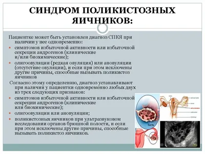 Синдром поликистозных яичников: причины, виды и диагностика 🌺 – Юнона