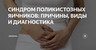 Нетипичный СПКЯ Поликистоз яичников встречается у каждой пятой девушки.  🔺️Избыточный рост волос на верхней губе и в интимной… | Instagram