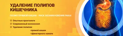 Анальные полипы - причины, симптомы, диагностика, лечение и профилактика